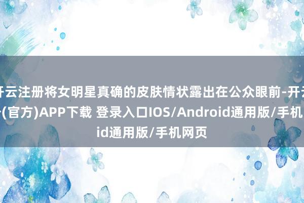 开云注册将女明星真确的皮肤情状露出在公众眼前-开云注册(官方)APP下载 登录入口IOS/Android通用版/手机网页